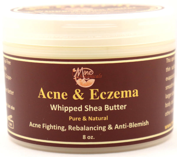 Acne & Eczema - Whipped Shea Butter